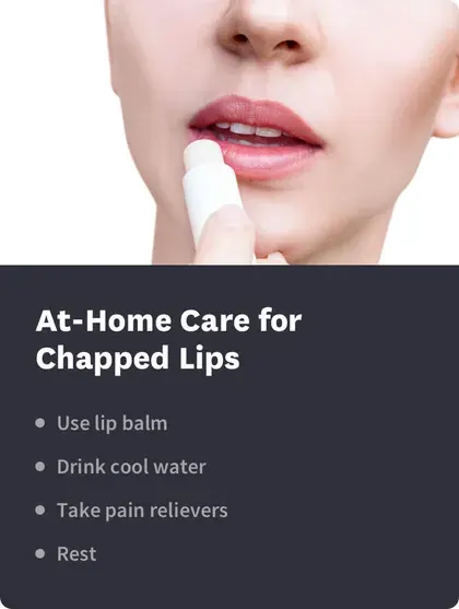 At-Home Care for Chapped Lips