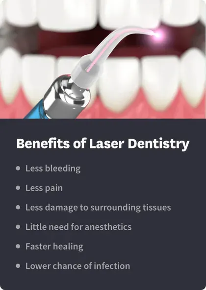 Benefits of Laser Dentistry