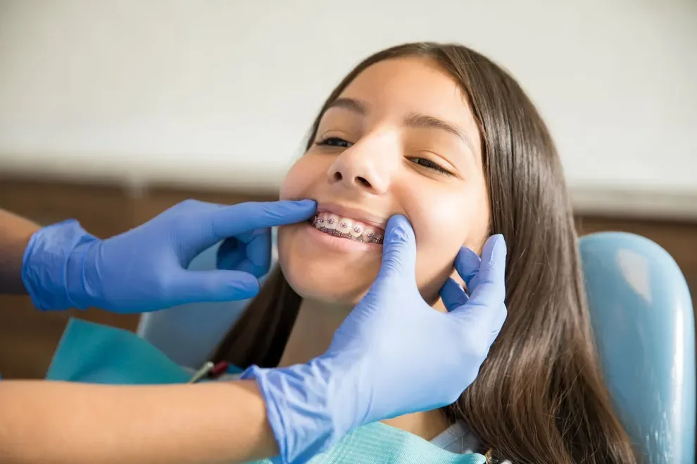 checking braces