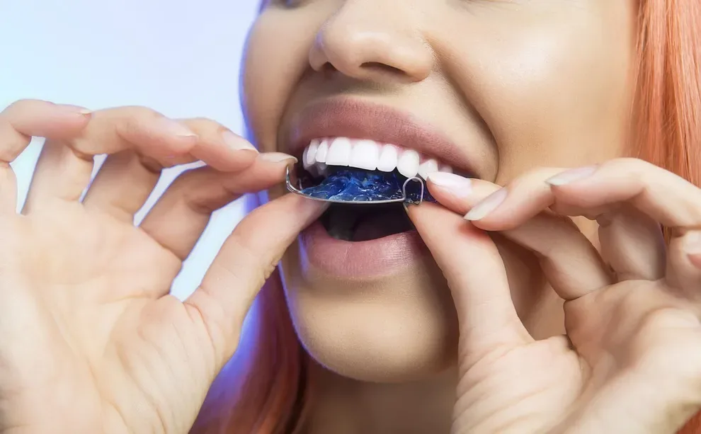 can-you-wear-an-old-retainer-to-straighten-teeth