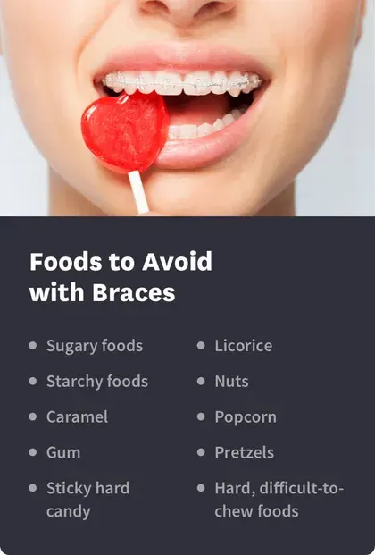Foods to Avoid with Braces