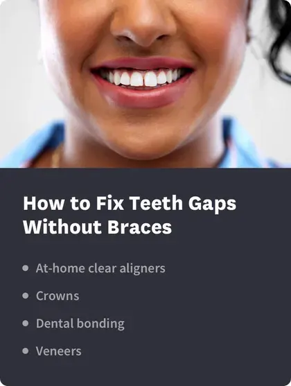 How to Fix Teeth Gaps Without Braces
