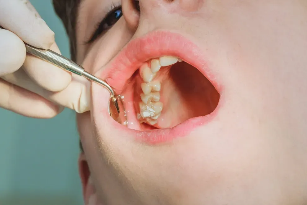 person-getting-teeth-and-gums-examined