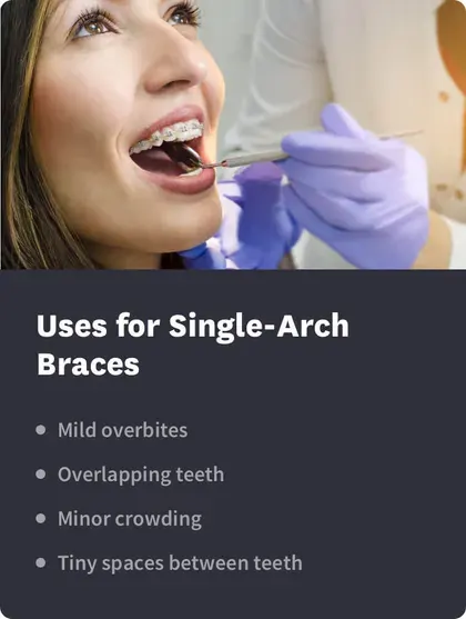 Uses for Single-Arch Braces