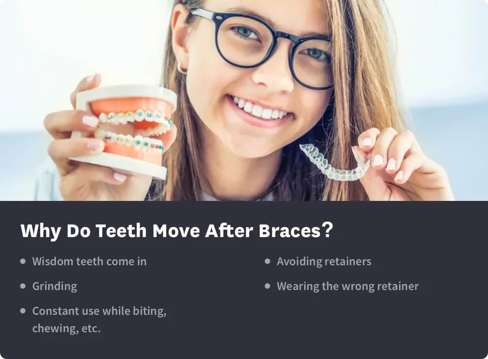 Why Do Teeth Move After Treatment