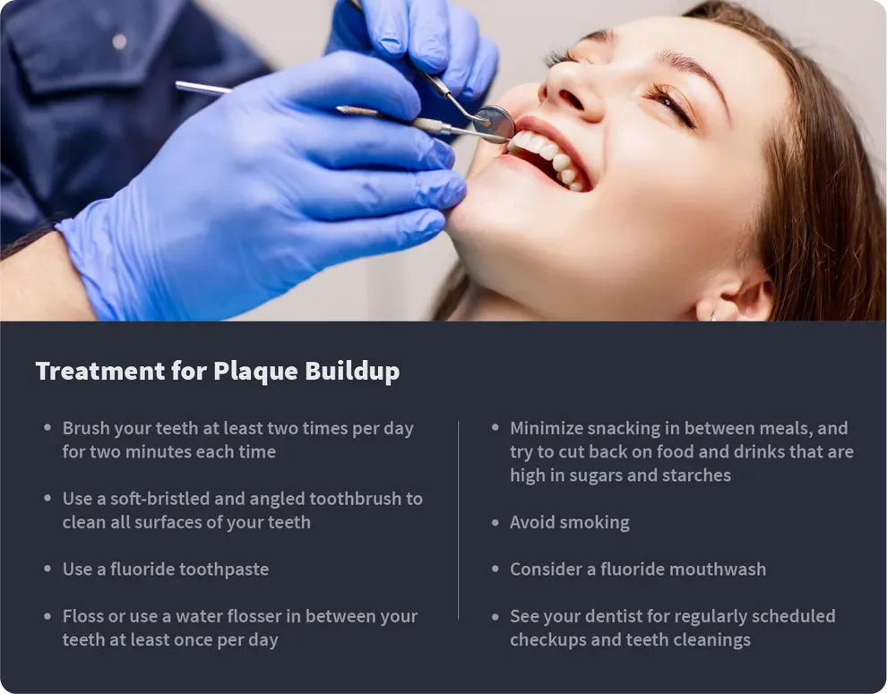 treatment for plaque buildup